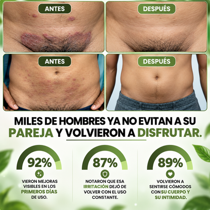 Bartila - Crema de Cuidado Para los Pliegues de la Piel
