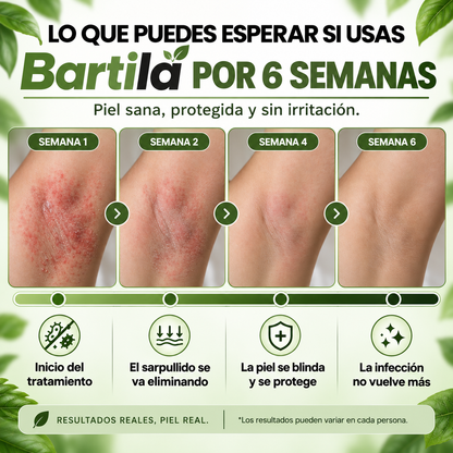 Bartila - Crema de Cuidado Para los Pliegues de la Piel