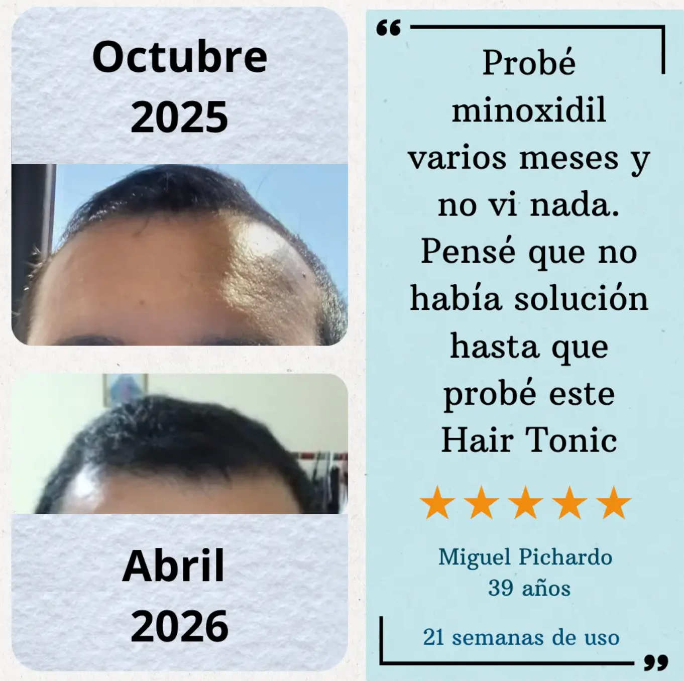 Hair Tonic - Crecimiento Capilar