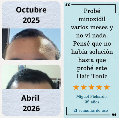 Hair Tonic - Crecimiento Capilar